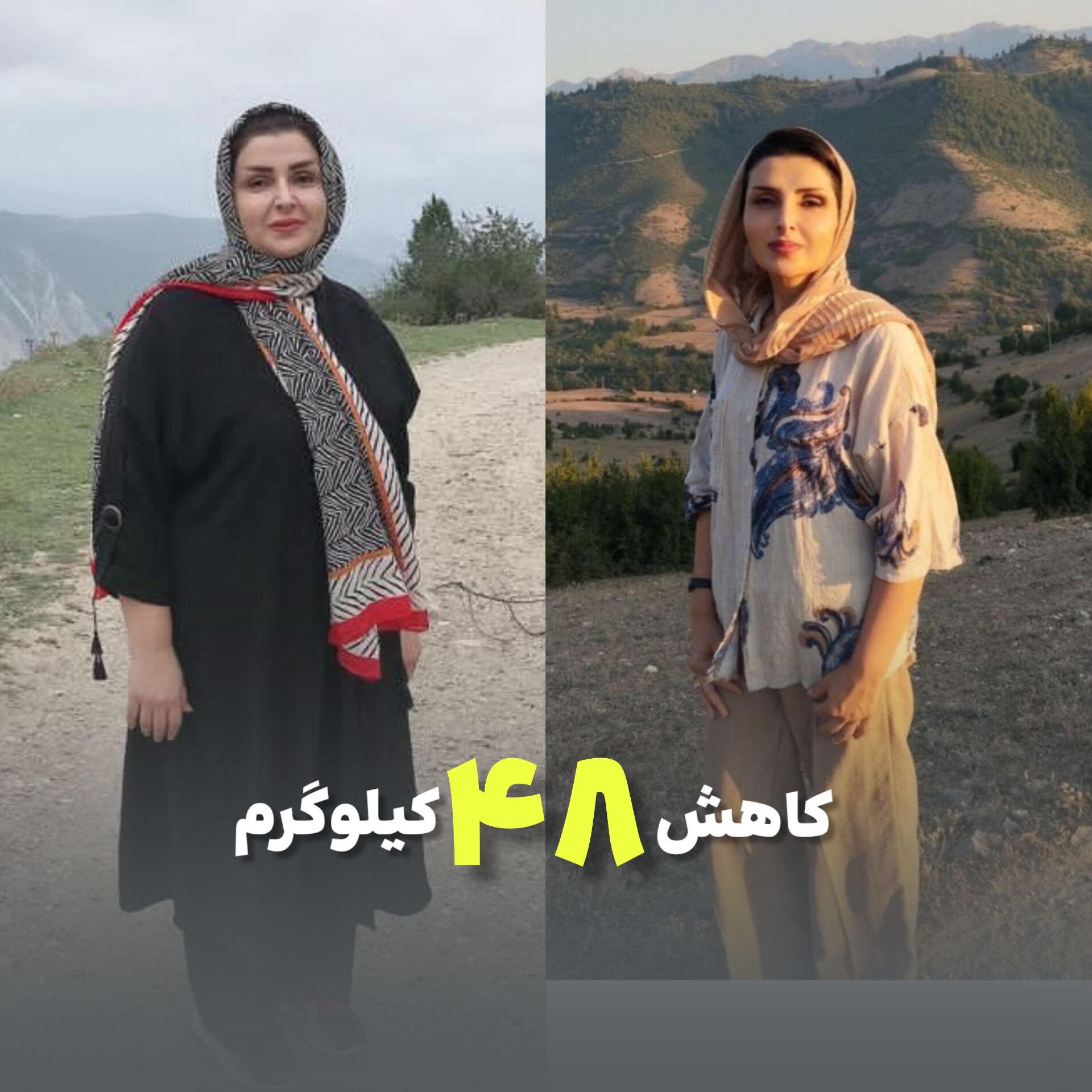 وزن اولیه 103 . وزن بعدی 55 کیلو . 7 ماه بعد از اسلیو